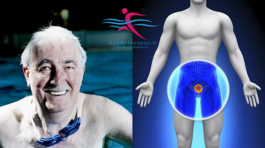 تأثیر آب‌درمانی بر درمان مشکلات پروستات: یک مقاله پژوهشی جامع